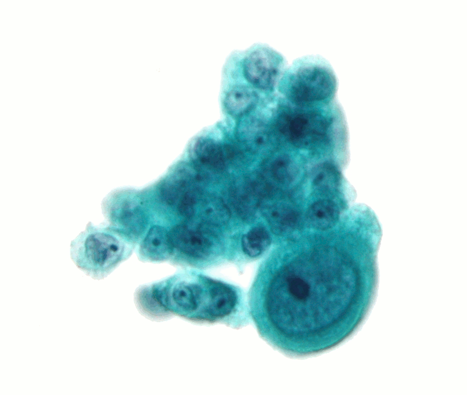 Resource image